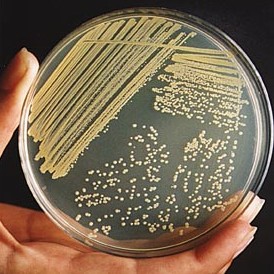 A very common bacteria called Staphylococcus aures growing on agar in a petri dish. Photo courtesy, Science Buddies